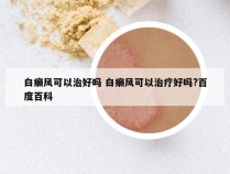 白癞风可以治好吗 白癞风可以治疗好吗?百度百科