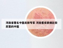 河南省著名中医皮肤专家 河南看皮肤病比较厉害的中医