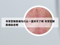 寻常型银屑病为什么一直好不了呢 寻常型银屑病自愈吧
