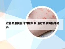 改善血液微循环对银屑病 治疗血液微循环的药