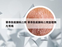 草市街皮肤科二院 草市街皮肤科二院坐地铁几号线