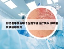 廊坊看牛皮癣哪个医院专业治疗失眠 廊坊看皮肤病哪里好