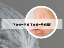 下身长一块癣 下身长一块癣图片