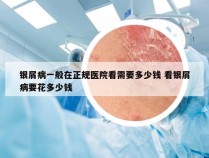 银屑病一般在正规医院看需要多少钱 看银屑病要花多少钱