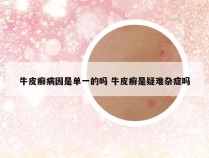 牛皮癣病因是单一的吗 牛皮癣是疑难杂症吗