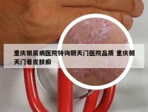 重庆银屑病医院特询朝天门医院品质 重庆朝天门看皮肤癣