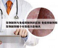 生物制剂与免疫抑制剂的区别 免疫抑制剂和生物制剂哪个对免疫力影响大