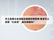 手上出现小水泡是在提醒你银屑病 原来手上出现“小水泡”,是在提醒你?