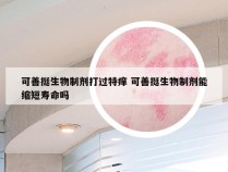 可善挺生物制剂打过特痒 可善挺生物制剂能缩短寿命吗