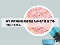 除了银屑病掉皮屑还有什么病掉皮屑 除了牛皮癣还有什么