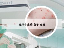 兔子牛皮癣 兔子 皮癣