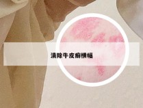 清除牛皮癣横幅