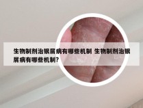 生物制剂治银屑病有哪些机制 生物制剂治银屑病有哪些机制?