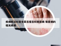 疾病概况科普文章百度百科银屑病 银屑病的相关疾病