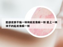 脸部皮肤干燥一块块蜕皮像癣一样 脸上一块块干的起皮像癣一样
