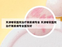 天津哪家医院治疗银屑病专业 天津哪家医院治疗银屑病专业医生好