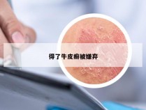 得了牛皮癣被嫌弃