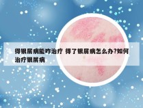 得银屑病能咋治疗 得了银屑病怎么办?如何治疗银屑病