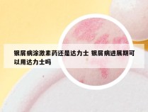 银屑病涂激素药还是达力士 银屑病进展期可以用达力士吗