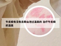 牛皮癣有没有去鞍山泡过温泉的 治疗牛皮癣的温泉