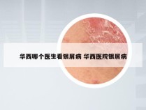 华西哪个医生看银屑病 华西医院银屑病