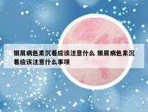 银屑病色素沉着应该注意什么 银屑病色素沉着应该注意什么事项