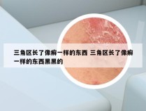 三角区长了像癣一样的东西 三角区长了像癣一样的东西黑黑的