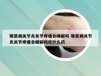 银屑病关节炎关节疼痛会缓解吗 银屑病关节炎关节疼痛会缓解吗吃什么药
