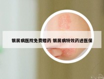 银屑病医院免费赠药 银屑病特效药进医保