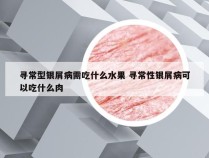 寻常型银屑病需吃什么水果 寻常性银屑病可以吃什么肉
