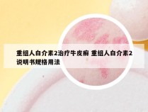 重组人白介素2治疗牛皮癣 重组人白介素2说明书规格用法