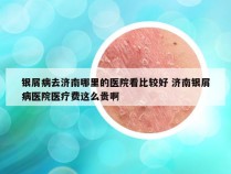 银屑病去济南哪里的医院看比较好 济南银屑病医院医疗费这么贵啊