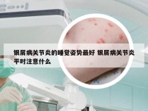 银屑病关节炎的睡觉姿势最好 银屑病关节炎平时注意什么