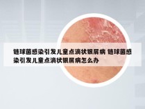 链球菌感染引发儿童点滴状银屑病 链球菌感染引发儿童点滴状银屑病怎么办