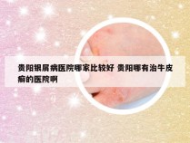 贵阳银屑病医院哪家比较好 贵阳哪有治牛皮癣的医院啊