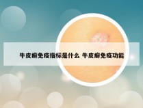 牛皮癣免疫指标是什么 牛皮癣免疫功能