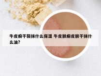 牛皮癣干裂抹什么保湿 牛皮肤癣皮肤干抹什么油?
