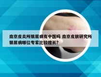 南京皮炎所银屑病有中医吗 南京皮肤研究所银屑病哪位专家比较擅长?