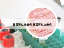 苦蒿可以洗癣吗 苦蒿可以止痒吗