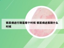 银屑病进行期是那个时候 银屑病进展期什么时候