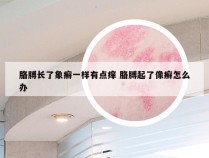 胳膊长了象癣一样有点痒 胳膊起了像癣怎么办