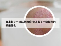 背上长了一块红色的癣 背上长了一块红色的癣是什么