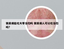 银屑病能吃大枣当归吗 银屑病人可以吃当归吗?