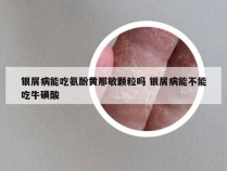 银屑病能吃氨酚黄那敏颗粒吗 银屑病能不能吃牛磺酸