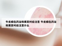 牛皮癣在药浴和熏蒸时应注意 牛皮癣在药浴和熏蒸时应注意什么