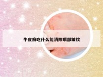 牛皮癣吃什么能消除眼部皱纹