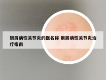 银屑病性关节炎的医名称 银屑病性关节炎治疗指南
