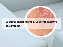点滴状银屑病应注意什么 点滴状银屑病吃什么药效果最好
