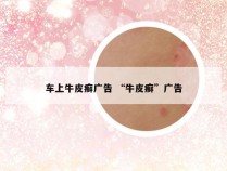 车上牛皮癣广告 “牛皮癣”广告