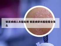 银屑病病人衣服处理 银屑病穿衣服捂着会发么